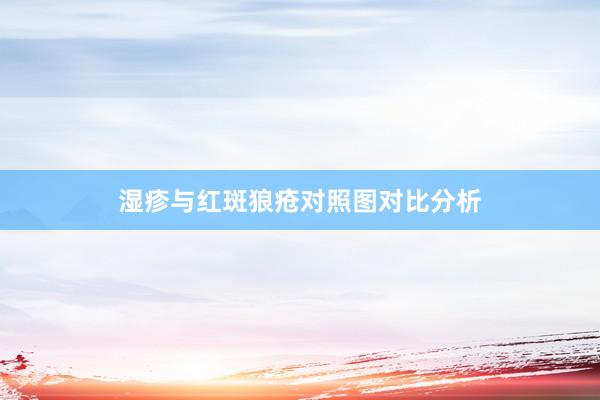 湿疹与红斑狼疮对照图对比分析